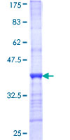 SDS-PAGE - Recombinant Human CPS1 protein (GST tag N-Terminus) (AB152296)