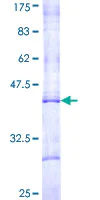 SDS-PAGE - Recombinant Human CPT1B protein (AB114959)