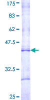SDS-PAGE - Recombinant Human CPT1B protein (GST tag N-Terminus) (AB114959)