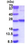 SDS-PAGE - Recombinant Human CPTP protein (AB187436), expandable thumbnail