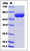 SDS-PAGE - Recombinant Human CPVL protein (His tag) (AB276666)