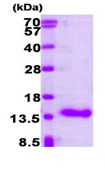 SDS-PAGE - Recombinant Human CRABP1 protein (AB87628)