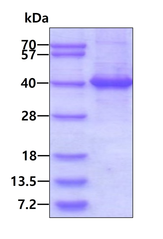 SDS-PAGE - Recombinant Human CRALBP protein (denatured) (His tag N-Terminus) (AB177594)