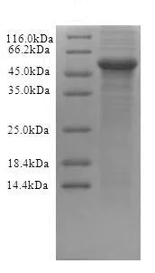 SDS-PAGE - Recombinant Human CRBN protein (His tag) (AB235611)