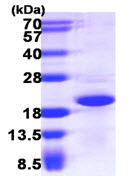 SDS-PAGE - Recombinant Human CRCP protein (His tag N-Terminus) (AB111636)