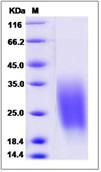 SDS-PAGE - Recombinant Human CREB3L1/OASIS protein (His tag) (AB276490), expandable thumbnail