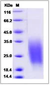 SDS-PAGE - Recombinant Human CREB3L1/OASIS protein (His tag) (AB276490)