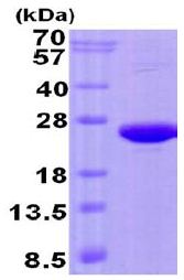 SDS-PAGE - Recombinant Human CREG1/CREG protein (His tag N-Terminus) (AB131699)