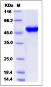 SDS-PAGE - Recombinant Human CRELD1 protein (His tag) (AB276537), expandable thumbnail