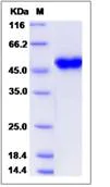 SDS-PAGE - Recombinant Human CRELD1 protein (His tag) (AB276537)