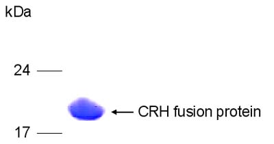 SDS-PAGE - Recombinant Human CRF protein (AB96279)