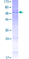 Recombinant Human CRF1/CRHR1 protein