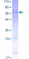 SDS-PAGE - Recombinant Human CRF1/CRHR1 protein (GST tag N-Terminus) (AB152297)