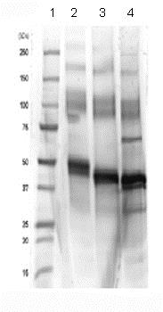 SDS-PAGE - Recombinant human Cripto1/CRIPTO protein (Fc Chimera) (AB84062), expandable thumbnail