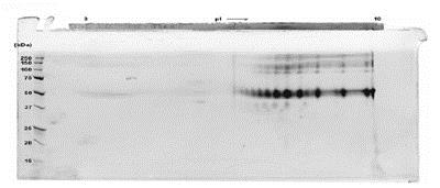 SDS-PAGE - Recombinant human Cripto1/CRIPTO protein (Fc Chimera) (AB84062), expandable thumbnail