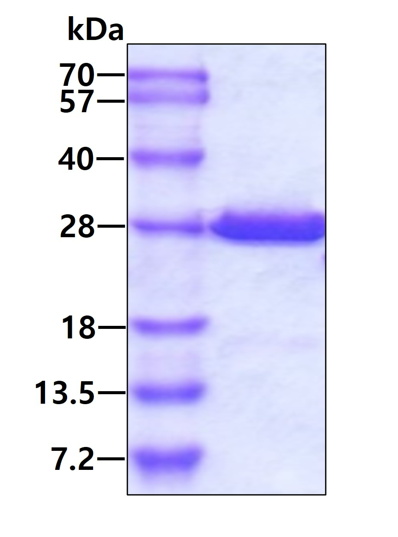 SDS-PAGE - Recombinant Human Crk p38 protein (AB101046), expandable thumbnail