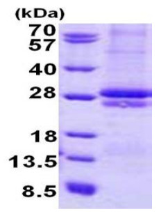 SDS-PAGE - Recombinant Human CRLF2 protein (denatured) (His tag N-Terminus) (AB140729)
