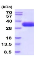 SDS-PAGE - Recombinant Human CRLF2 protein (His tag) (AB224784)