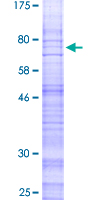 Recombinant Human CRLR protein