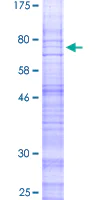 SDS-PAGE - Recombinant Human CRLR protein (AB160875)