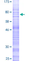 SDS-PAGE - Recombinant Human CRLR protein (GST tag N-Terminus) (AB160875)