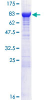 SDS-PAGE - Recombinant Human CRMP2 protein (AB114269), expandable thumbnail