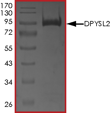 SDS-PAGE - Recombinant Human CRMP2 protein (Tagged) (AB268449), expandable thumbnail