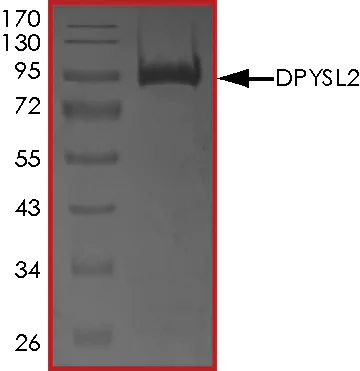 SDS-PAGE - Recombinant Human CRMP2 protein (Tagged) (AB268449)