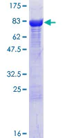 SDS-PAGE - Recombinant Human CRMP3 protein (AB132425)