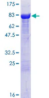 SDS-PAGE - Recombinant Human CRMP3 protein (AB132425)