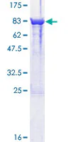 SDS-PAGE - Recombinant Human CRMP4 protein (AB132289)