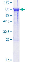 SDS-PAGE - Recombinant Human CRMP4 protein (AB132289)