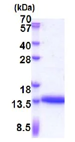 SDS-PAGE - Recombinant Human CRP-1 protein (AB171471)