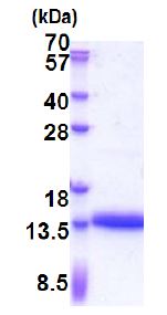 SDS-PAGE - Recombinant Human CRP-1 protein (His tag N-Terminus) (AB171471)