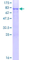 SDS-PAGE - Recombinant Human CRTAC1 protein (AB162966)