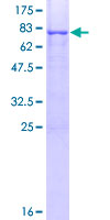 SDS-PAGE - Recombinant Human CRTAC1 protein (GST tag N-Terminus) (AB162966)