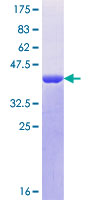SDS-PAGE - Recombinant Human CRTC3 protein (AB153493), expandable thumbnail