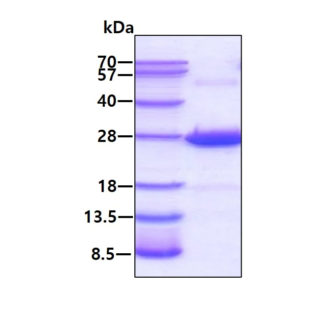 SDS-PAGE - Recombinant Human CRYBA4 protein (His tag N-Terminus) (AB113143)