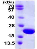 SDS-PAGE - Recombinant Human CRYGD protein (His tag N-Terminus) (AB111649)