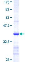 SDS-PAGE - Recombinant Human CSAD/CSD protein (AB162535)
