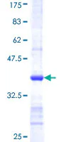 SDS-PAGE - Recombinant Human CSAD/CSD protein (GST tag N-Terminus) (AB162535)