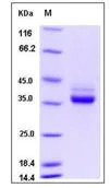 SDS-PAGE - Recombinant Human CSAG1 protein (Fc Chimera) (AB276435)