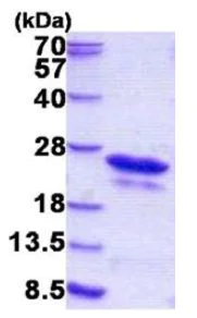 SDS-PAGE - Recombinant Human CSDC2 protein (AB156349)