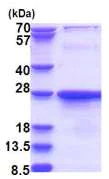 SDS-PAGE - Recombinant Human CSL4 protein (His tag N-Terminus) (AB181892)