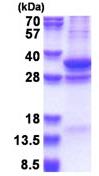 SDS-PAGE - Recombinant Human CSN7A protein (denatured) (AB180281), expandable thumbnail