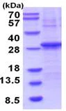 SDS-PAGE - Recombinant Human CSP-C protein (denatured) (His tag N-Terminus) (AB202612)
