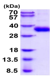 SDS-PAGE - Recombinant Human CSP-C protein (His tag) (AB219218)