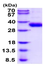 SDS-PAGE - Recombinant Human CSP-C protein (His tag) (AB219218)