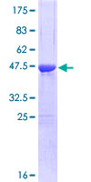 SDS-PAGE - Recombinant Human CSRP1 protein (AB114649)