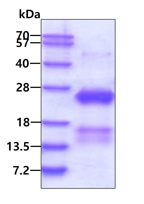 SDS-PAGE - Recombinant Human CSRP2/Dlp1 protein (AB126663), expandable thumbnail